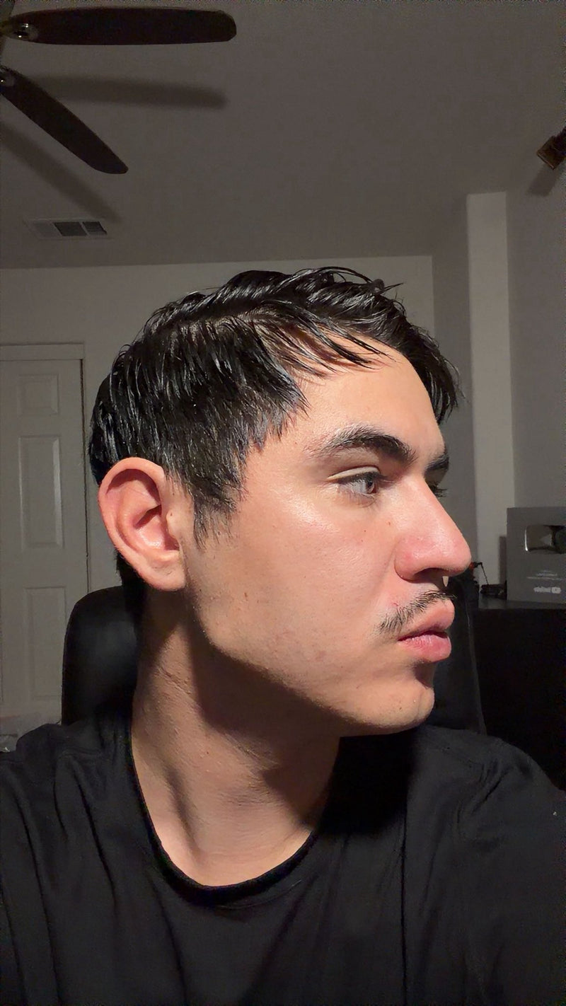 After — sharp jaw