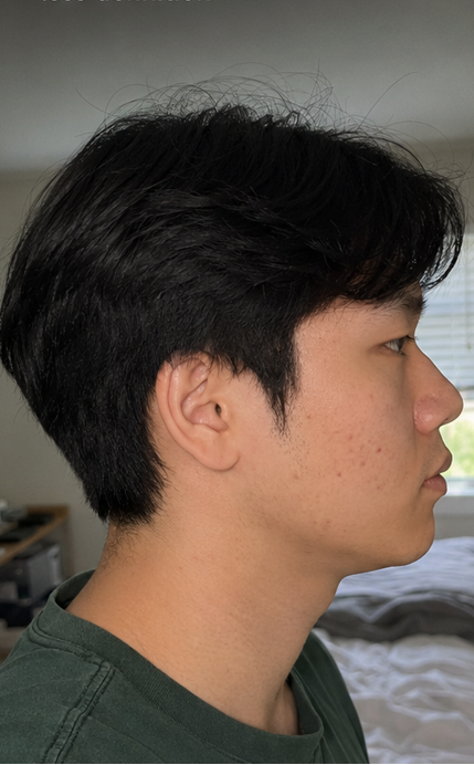 After