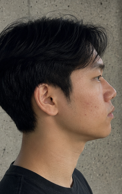 Before